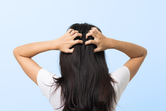 Scratchy Scalp? 5 Ways To Ditch That Itch