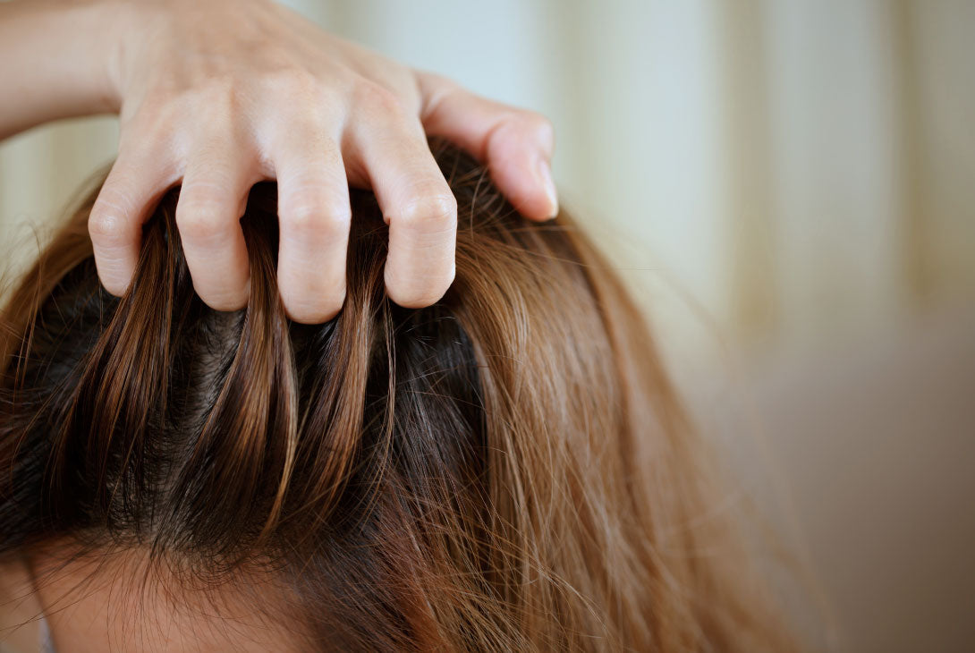 Scalp Dermatitis: Causes & Solutions for Healthier Hair