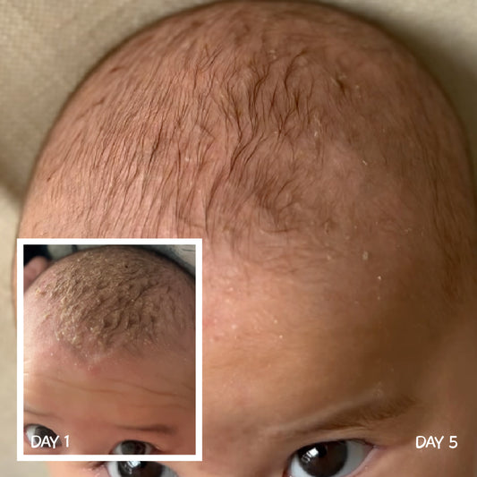 Scalp Repair Cream 120g