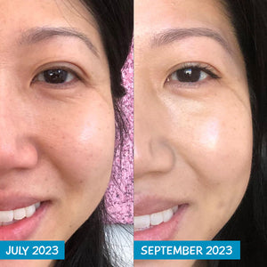Before and after photo of a woman's face showing the effect MooGoo's Amplified Anti-Ageing Peptide Active Serum 25ml has on the face. her skin roughness, radiance, firmness, elasticity, and facial volume is improved.