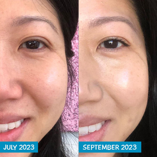 aod9604 peptide before and after Therapy in Paradise Valley, AZ MooGoo Amplified Peptide Active Serum