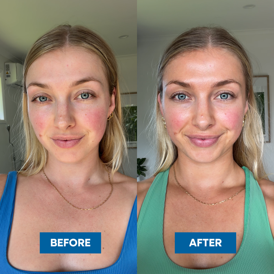 Before and after split screen comparison of a woman's face, showing a glowier, darker, tanner complexion in the after image. The left side is labeled 'BEFORE' and shows a woman in a blue top, while the right side is labeled 'AFTER' and shows the same woman in a green top. 